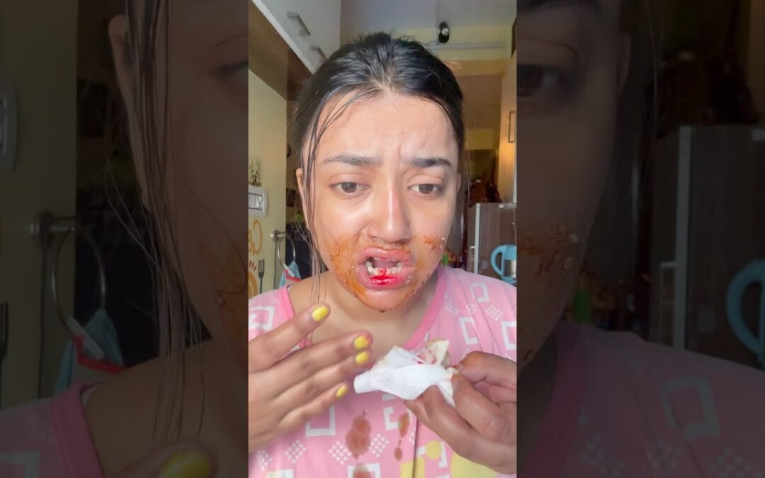 Shoking* 😱👄 Lips se Blood 🤯🩸 #lips #makeuphacks #short #shorts #trendinghacks #shortvideo #hack #lip